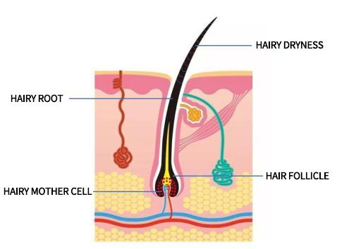 hair follicle removal